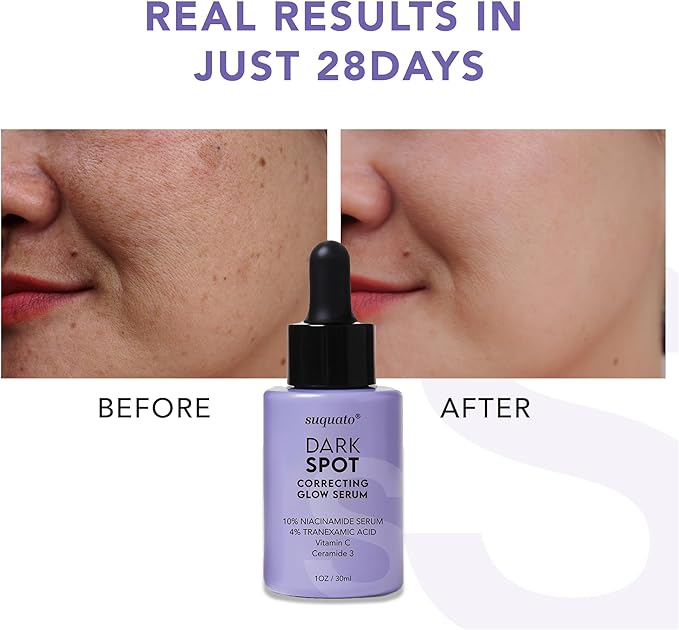 Suquato Dark Spot Correcting Glow Serum